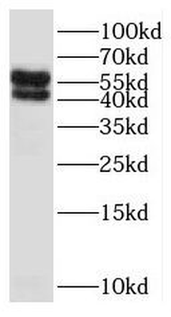 SLC18A1 Antibody