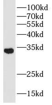 SLC25A1 Antibody