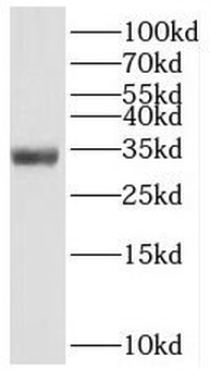 SLC25A2 Rabbit Polyclonal Antibody