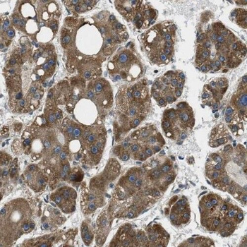 SLC25A2 Rabbit Polyclonal Antibody