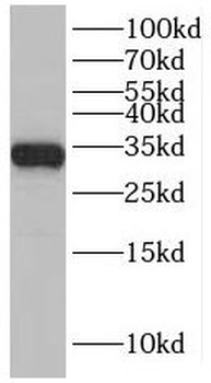 SLC25A22 Antibody