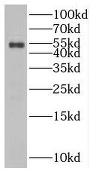 SLC25A23 Rabbit Polyclonal Antibody