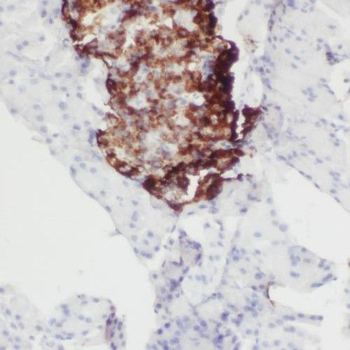 SLC25A23 Rabbit Polyclonal Antibody