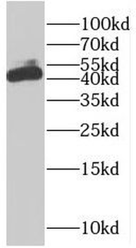 SLC25A46 Rabbit Polyclonal Antibody