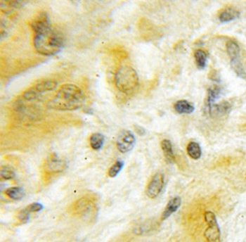 SLC25A46 Rabbit Polyclonal Antibody