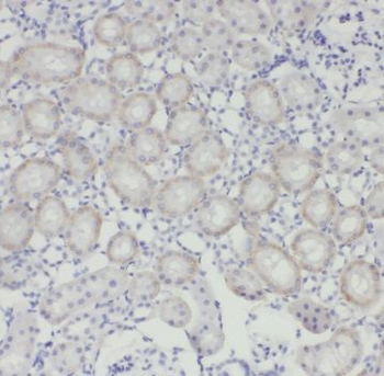 SLC25A5 Rabbit Polyclonal Antibody