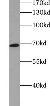 SLC27A2 Rabbit Polyclonal Antibody