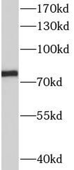 SLC34A2 Rabbit Polyclonal Antibody