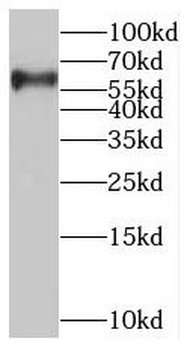 SLC37A1 Rabbit Polyclonal Antibody