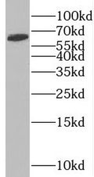 SLC38A1 Rabbit Polyclonal Antibody