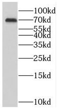 SLC38A3 Rabbit Polyclonal Antibody