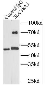 SLC38A3 Rabbit Polyclonal Antibody
