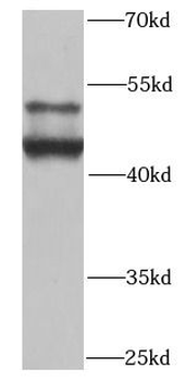 SMAD9 Rabbit Polyclonal Antibody