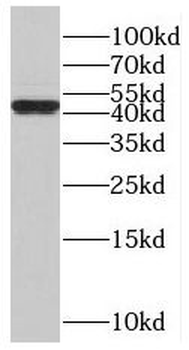 SMAP2 Rabbit Polyclonal Antibody
