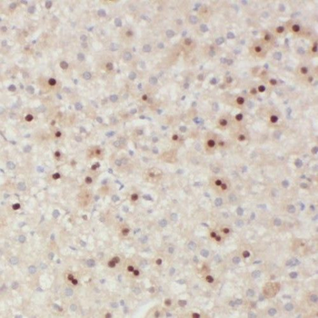 SMAP2 Rabbit Polyclonal Antibody