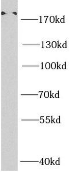 SMARCA4 Antibody