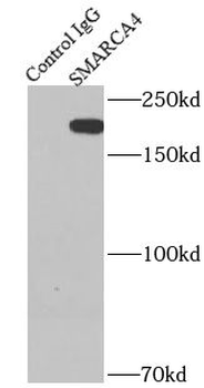 SMARCA4 Antibody