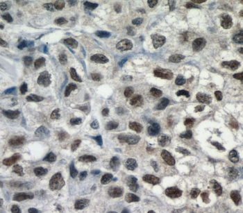 SMARCA4 Antibody