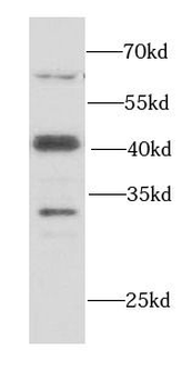 SMARCB1 Antibody
