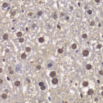 SMARCB1 Antibody