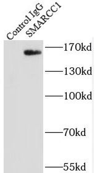 SMARCC1 Antibody