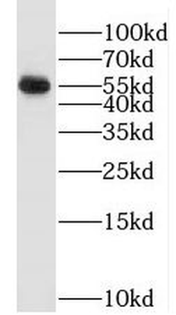 SMARCD3 Rabbit Polyclonal Antibody