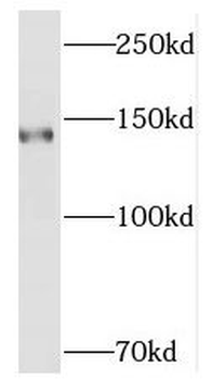 SMC3 Rabbit Polyclonal Antibody