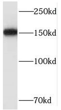 SMC4 Rabbit Polyclonal Antibody