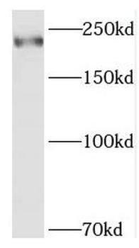 SMCHD1 Rabbit Polyclonal Antibody