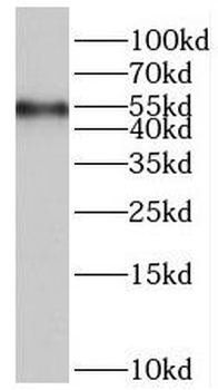 PPP4R3B Rabbit Polyclonal Antibody