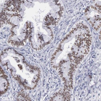 PPP4R3B Rabbit Polyclonal Antibody