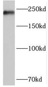 MYH11 Rabbit Polyclonal Antibody