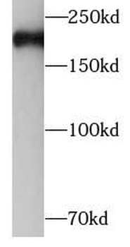 MYH11 Rabbit Polyclonal Antibody