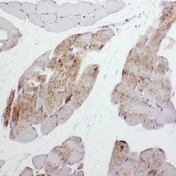 MYH11 Rabbit Polyclonal Antibody