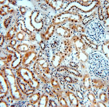 SMN1 Rabbit Polyclonal Antibody
