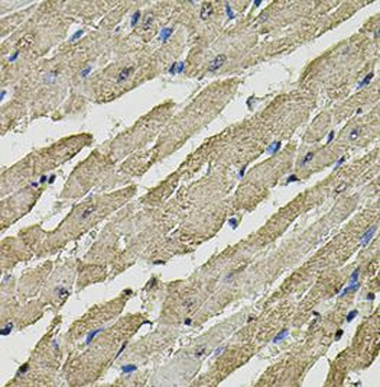 SMN1 Rabbit Polyclonal Antibody