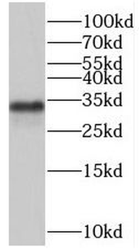 SMNDC1 Antibody
