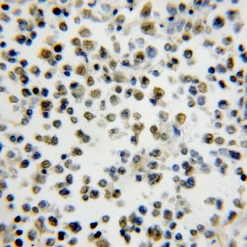 SMNDC1 Antibody