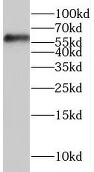 SMPD1 Rabbit Polyclonal Antibody