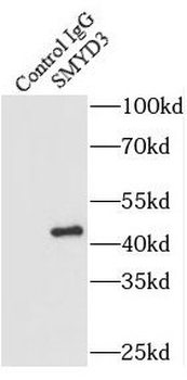 SMYD3 Antibody