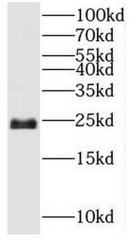 SNAP23 Rabbit Polyclonal Antibody