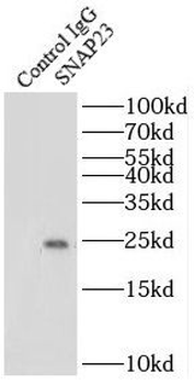 SNAP23 Rabbit Polyclonal Antibody