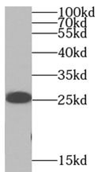 SNAP25 Rabbit Polyclonal Antibody