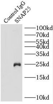 SNAP25 Rabbit Polyclonal Antibody