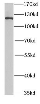 SND1 Rabbit Polyclonal Antibody