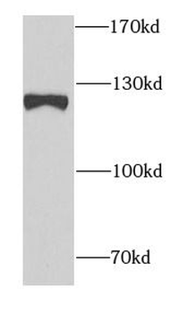 SND1 Mouse Monoclonal Antibody