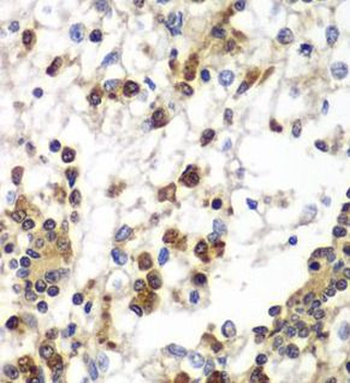 SND1 Mouse Monoclonal Antibody