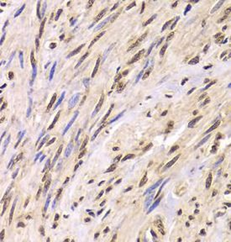 SNRPA Rabbit Polyclonal Antibody