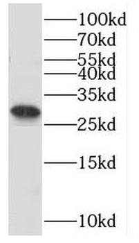 SNRPA1 Antibody
