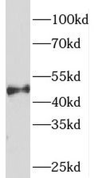 SNX6 Antibody